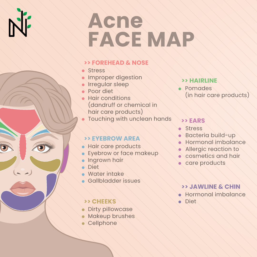 Acne Types Causes Symptoms Prevention Treatment Everything You acne-types-causes-symptoms-prevention-treatment-everything-you