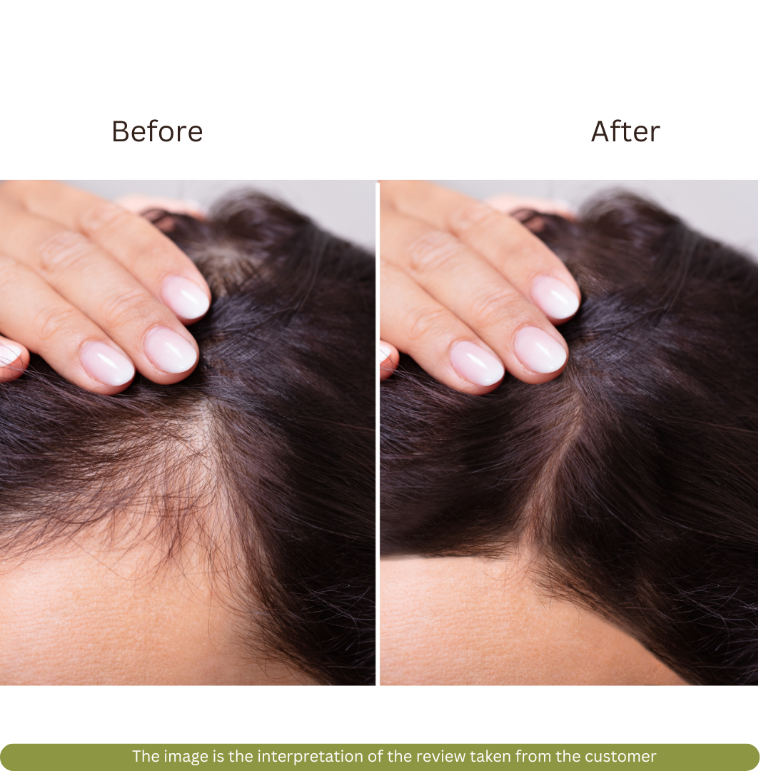 Rosemary Hair Oil - Hair Growth Treatment for Scalp