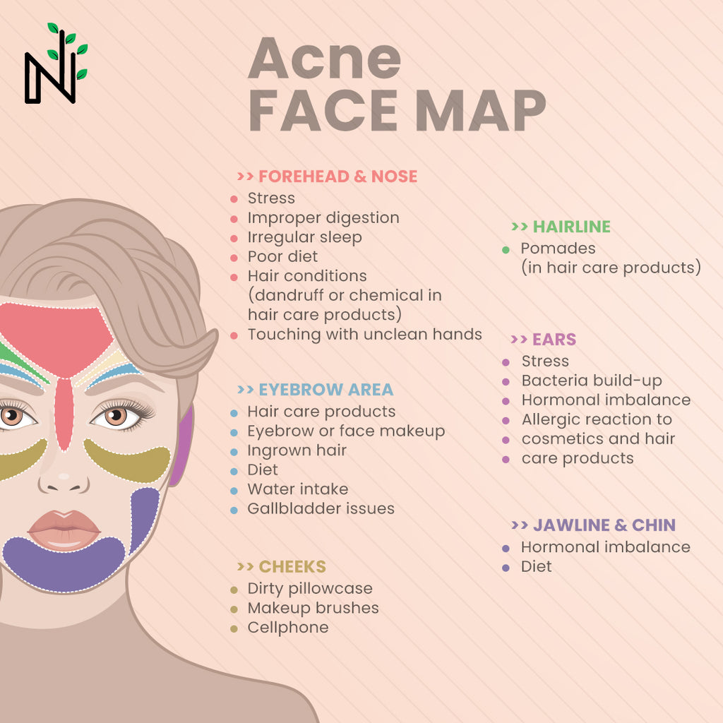 Acne - Types, Causes, Symptoms, Prevention, Treatment: Everything You Need to Know