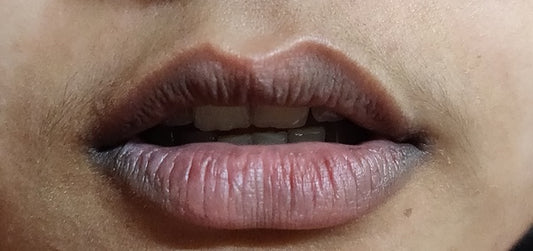 How to get rid of dark lips?