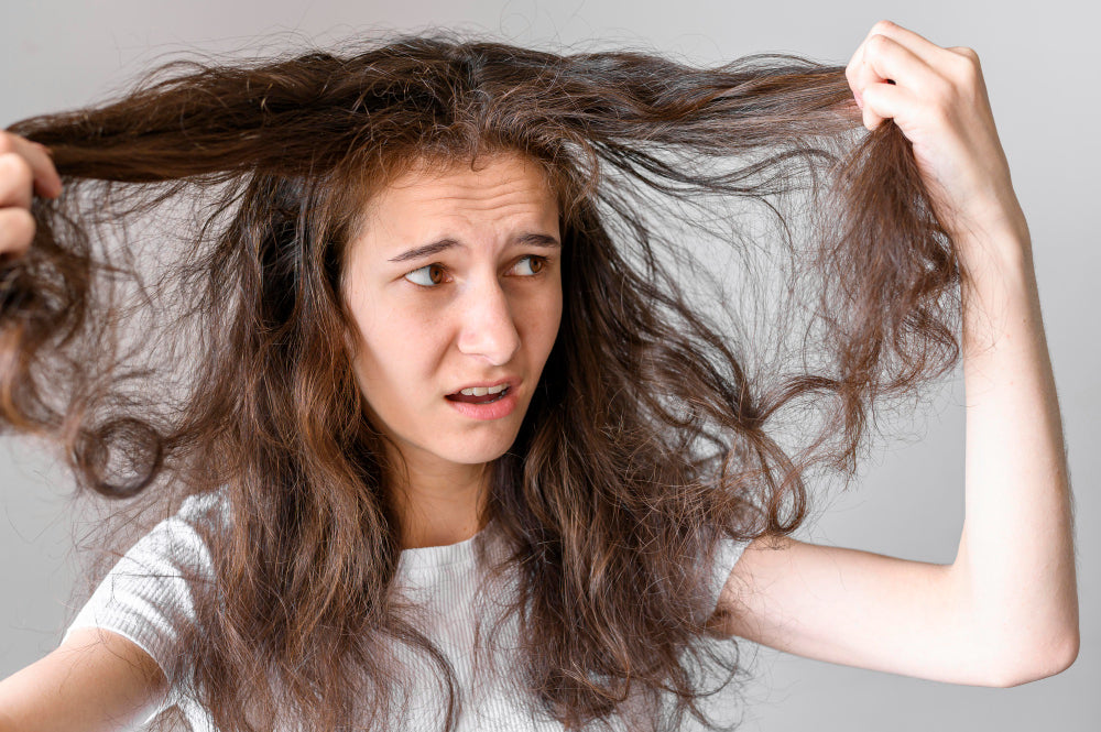 PCOS related Hair Loss : Causes, Treatments, Home Remedies
