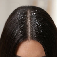 Best dandruff shampoo in pakistan