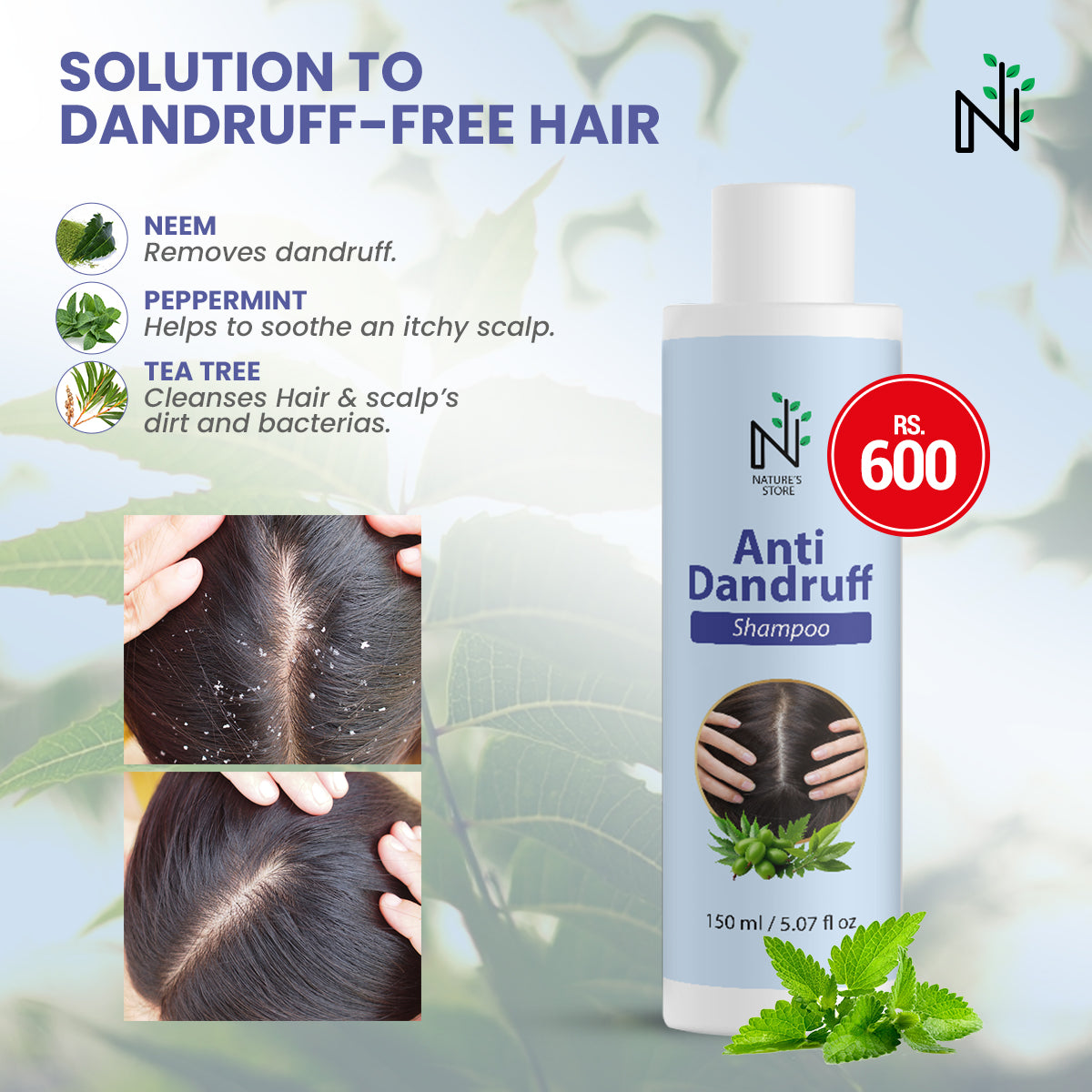 Best Herbal Anti Dandruff Shampoo