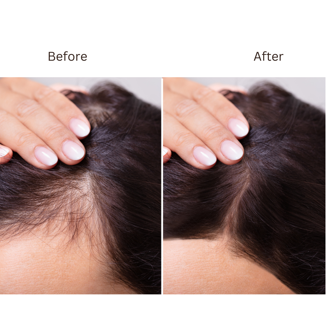 Rosemary Hair Oil - Hair Growth Treatment for Scalp