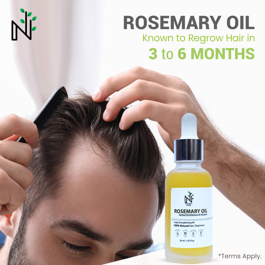 Rosemary Oil for male pattern baldness in Pakistan