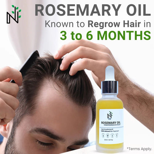 Rosemary Hair Oil - Hair Growth Treatment for Scalp